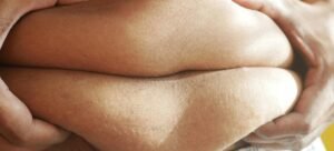 Read more about the article السمنة في العالم العربي: أسبابها، آثارها، وحلولها الصحية